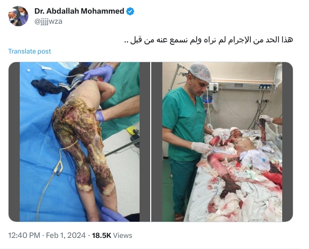 An X (Twitter) post from @jjjjwza - Dr. Abdallah Mohammed